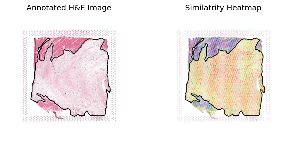 ../_images/notebooks_Loki_Annotate_case_study_bulk_RNAseq_18_0.png