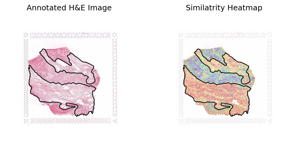 ../_images/notebooks_Loki_Annotate_case_study_bulk_RNAseq_25_0.png
