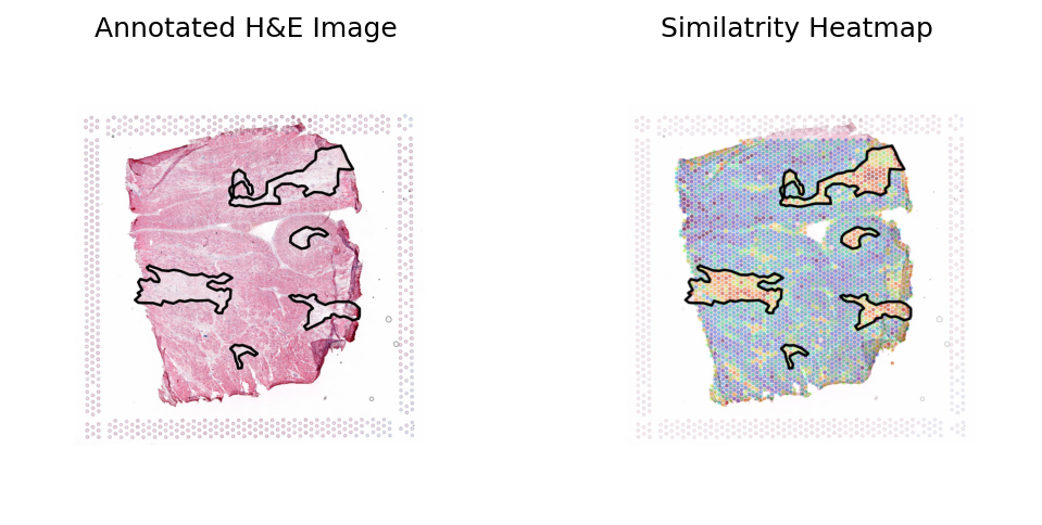 ../_images/notebooks_Loki_Annotate_case_study_bulk_RNAseq_32_0.png