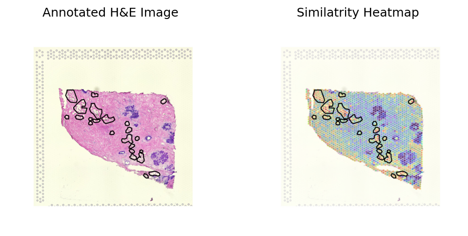 ../_images/notebooks_Loki_Annotate_case_study_bulk_RNAseq_41_0.png