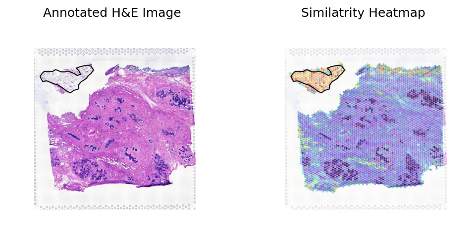 ../_images/notebooks_Loki_Annotate_case_study_bulk_RNAseq_48_0.png