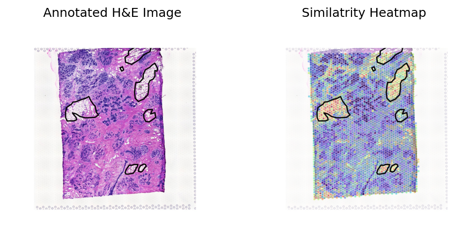 ../_images/notebooks_Loki_Annotate_case_study_bulk_RNAseq_55_0.png
