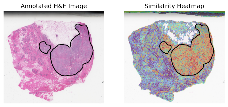 ../_images/notebooks_Loki_Annotate_case_study_bulk_RNAseq_9_1.png