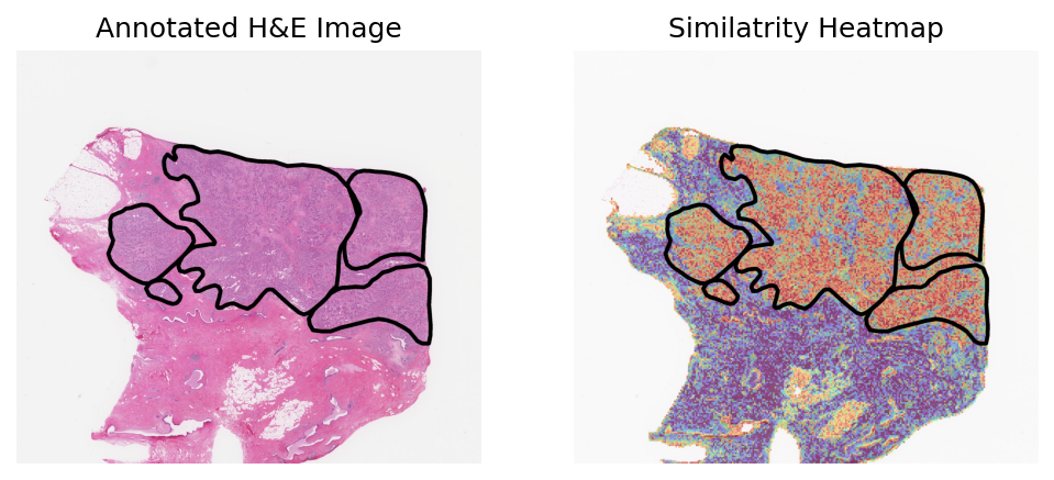 ../_images/notebooks_Loki_Annotate_case_study_bulk_RNAseq_9_3.png