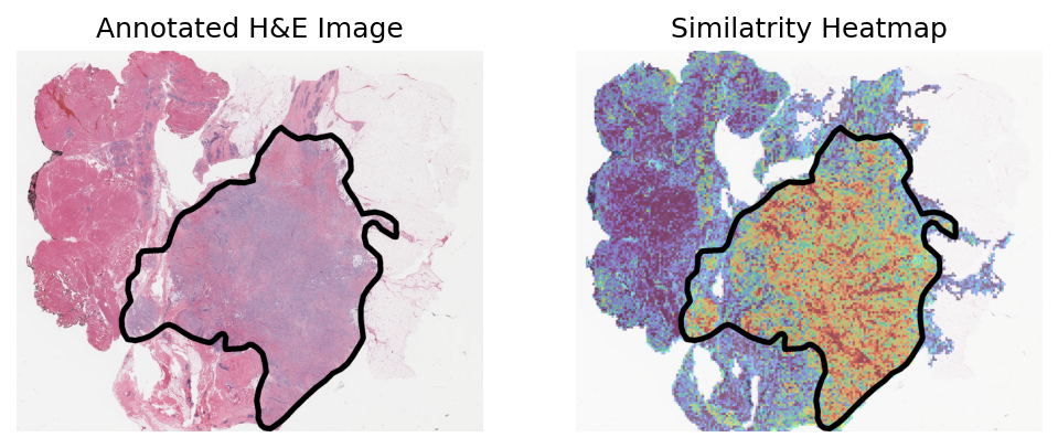 ../_images/notebooks_Loki_Annotate_case_study_bulk_RNAseq_9_5.png