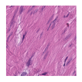 ../_images/notebooks_Loki_Annotate_case_study_marker_genes_8_13.png