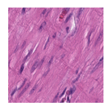 ../_images/notebooks_Loki_Annotate_case_study_marker_genes_8_15.png