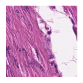../_images/notebooks_Loki_Annotate_case_study_marker_genes_8_19.png