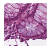 ../_images/notebooks_Loki_Annotate_case_study_marker_genes_8_21.png