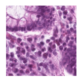 ../_images/notebooks_Loki_Annotate_case_study_marker_genes_8_29.png