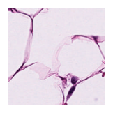 ../_images/notebooks_Loki_Annotate_case_study_marker_genes_8_3.png