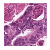 ../_images/notebooks_Loki_Annotate_case_study_marker_genes_8_33.png