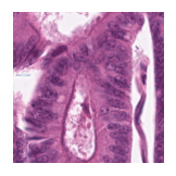 ../_images/notebooks_Loki_Annotate_case_study_marker_genes_8_37.png