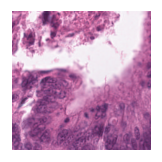 ../_images/notebooks_Loki_Annotate_case_study_marker_genes_8_39.png