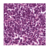 ../_images/notebooks_Loki_Annotate_case_study_marker_genes_8_41.png