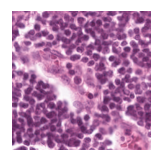 ../_images/notebooks_Loki_Annotate_case_study_marker_genes_8_47.png
