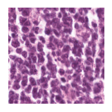 ../_images/notebooks_Loki_Annotate_case_study_marker_genes_8_49.png