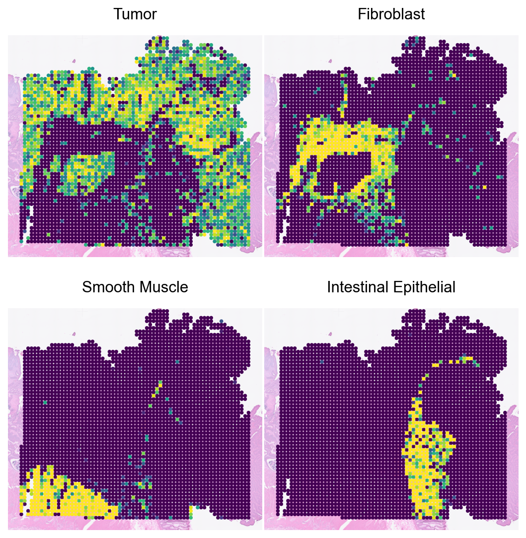../_images/notebooks_Loki_Decompose_case_study_CRC_20_0.png